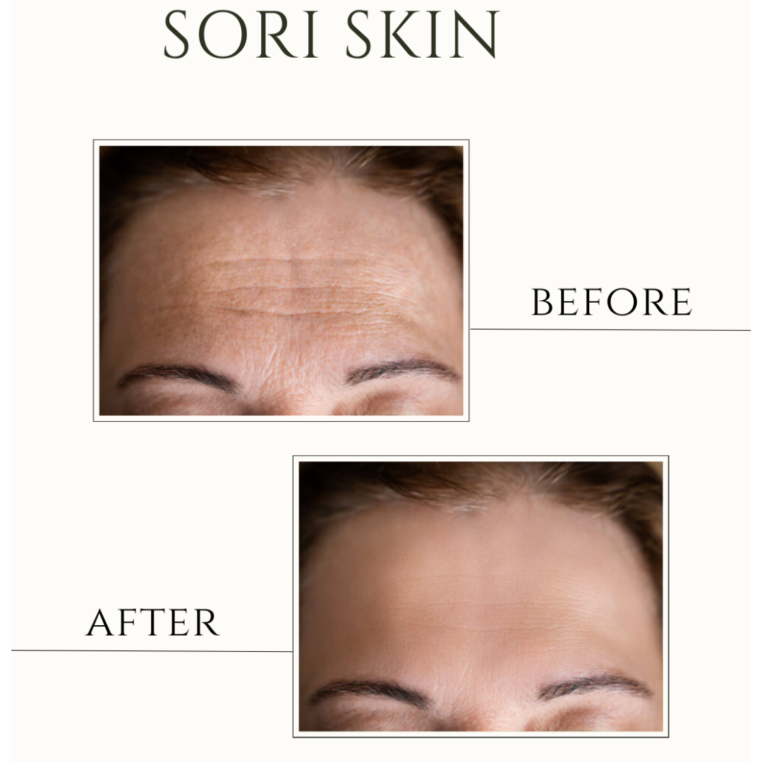 Silk Peptide Treatment